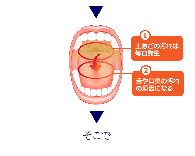 舌や口奥の汚れの原因になる